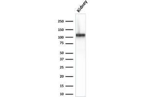 Western Blot Analysis of Human Kidney lysate using CDH16-Monospecific Mouse Monoclonal Antibody (CDH16/2125) (Cadherin-16 antibody  (AA 371-507))