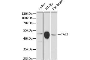 Western blot analysis of extracts of various cell lines, using T antibody (ABIN6132557, ABIN6148834, ABIN6148835 and ABIN6216741) at 1:3000 dilution. (TAL1 antibody  (AA 242-331))