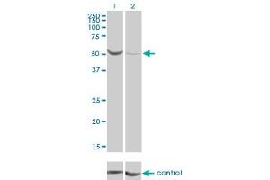Western blot analysis of PGM1 over-expressed 293 cell line, cotransfected with PGM1 Validated Chimera RNAi (Lane 2) or non-transfected control (Lane 1). (Phosphoglucomutase 1 antibody  (AA 1-562))