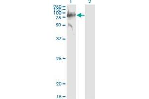 Western Blotting (WB) image for anti-Serpin Peptidase Inhibitor, Clade G (C1 Inhibitor), Member 1 (SERPING1) (AA 1-500) antibody (ABIN513846)