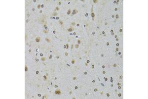 Immunohistochemistry of paraffin-embedded rat brain using DDX1 Antibody (ABIN5973950) at dilution of 1/100 (40x lens). (DDX1 antibody)
