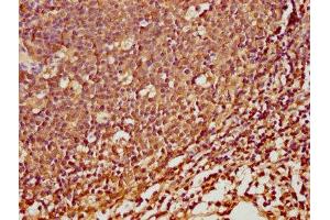 IHC image of ABIN7168929 diluted at 1:100 and staining in paraffin-embedded human tonsil tissue performed on a Leica BondTM system. (SPINK5 antibody  (AA 722-847))