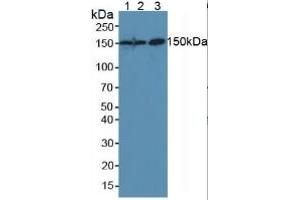 Detection antibody from the kit in WB with Positive Control:  Sample Lane1: Mouse Placenta Tissue; Lane2: Mouse Liver Tissue; Lane3: Human Hela Cells. (CEA ELISA Kit)