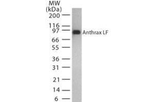 Image no. 1 for anti-Anthrax Toxin Lethal Factor (Lef) (AA 779-792) antibody (ABIN200035) (Anthrax Toxin Lethal Factor antibody  (AA 779-792))