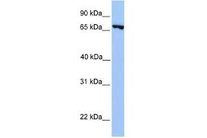PRDM6 antibody used at 0. (PRDM6 antibody  (N-Term))