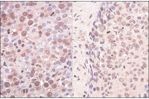 Immunohistochemistry (IHC) image for anti-Structural Maintenance of Chromosomes Flexible Hinge Domain Containing 1 (SMCHD1) (AA 250-300) antibody (ABIN7453787)