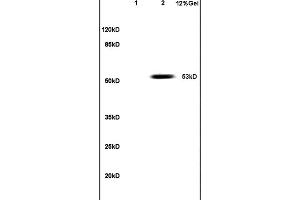 Lane 1: mouse embryo lysates Lane 2: human colon carcinoma lysates probed with Anti PAX3 Polyclonal Antibody, Unconjugated (ABIN737616) at 1:200 in 4C.