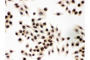 IHC testing of FFPE human SMMC-7221 cells with EIF3A antibody. (EIF6 antibody  (AA 66-210))