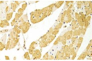Immunohistochemistry of paraffin-embedded Rat heart using PLCB1 Polyclonal Antibody at dilution of 1:100 (40x lens). (Phospholipase C beta 1 antibody)