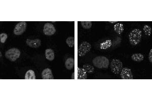 Immunofluorescent staining of HT1080 cells (ATCC CCL-121). (TP53BP1 antibody  (AA 149-259))