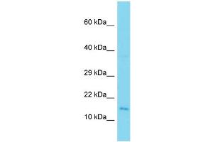 Host: Rabbit  Target Name: 1700026L06Rik  Sample Tissue: Mouse Testis lysates  Antibody Dilution: 1. (Spaca9 (C-Term) antibody)