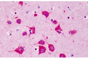 Human Brain, Cortex: Formalin-Fixed, Paraffin-Embedded (FFPE) (FKBP3 antibody  (AA 2-195))