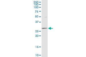 DCI MaxPab polyclonal antibody. (DCI antibody  (AA 1-243))