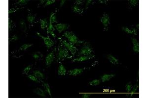 Immunofluorescence of monoclonal antibody to CFL2 on HeLa cell. (Cofilin 2 antibody  (AA 57-166))