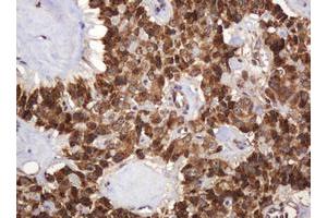 Image no. 5 for anti-B and T Lymphocyte Associated (BTLA) antibody (ABIN1496983)