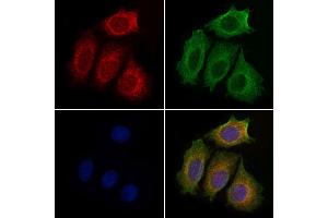 ABIN6259147 and ABIN6274943 staining Hela cells by IF/ICC.