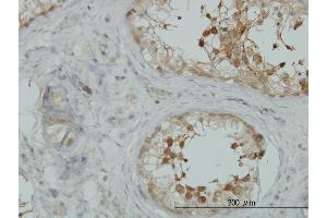 Immunoperoxidase of monoclonal antibody to AKAP10 on formalin-fixed paraffin-embedded human testis.