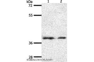 Western blot analysis of 293T and hela cell, using SSTR1 Polyclonal Antibody at dilution of 1:500 (SSTR1 antibody)