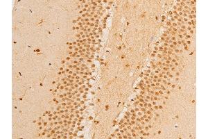 ABIN6267237 at 1/100 staining mouse brain tissue sections by IHC-P. (FOXO3 antibody  (pSer253))
