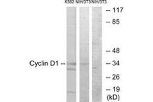 Western blot analysis of extracts from K562/NIH-3T3 cells, using Cyclin D1 (Ab-90) Antibody.