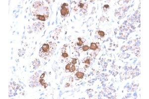 Formalin-fixed, paraffin-embedded human Pituitary stained with ACTH Rabbit Recombinant Monoclonal Antibody (CLIP/2040R). (Recombinant POMC antibody  (AA 1-24))
