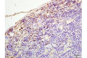 Formalin-fixed and paraffin embedded mouse spleen labeled with Rabbit Anti PLEKHM2/SKIP Polyclonal Antibody, Unconjugated (ABIN872446) at 1:200 followed by conjugation to the secondary antibody and DAB staining (PLEKHM2 antibody  (AA 688-750))
