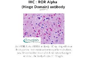Image no. 1 for anti-RAR-Related Orphan Receptor A (RORA) antibody (ABIN1738922) (RORA antibody)