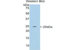 Western blot analysis of the recombinant protein. (RALBP1 antibody  (AA 192-380))