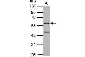 WB Image Sample (30 ug of whole cell lysate) A: HeLa 10% SDS PAGE antibody diluted at 1:1000 (ETS2 antibody  (Center))