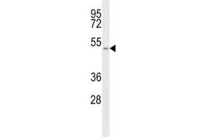 Western Blotting (WB) image for anti-Solute Carrier Family 16, Member 1 (Monocarboxylic Acid Transporter 1) (SLC16A1) (AA 430-460) antibody (ABIN3028819)