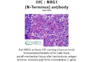 Image no. 1 for anti-Neuregulin 1 (NRG1) (Isoform 10) antibody (ABIN1737529) (Neuregulin 1 antibody  (Isoform 10))