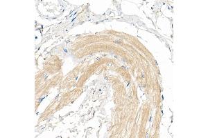 Immunohistochemistry of paraffin-embedded Human skeletal muscle using COX7 Rabbit pAb (4721) at dilution of 1:50 (40x lens). (COX7A1 antibody  (AA 1-79))