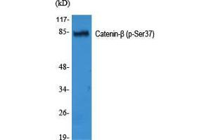 Western Blot (WB) analysis of specific cells using Phospho-Catenin-beta (S37) Polyclonal Antibody. (beta Catenin antibody  (pSer37))