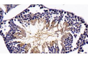 Detection of SIRT5 in Mouse Testis Tissue using Polyclonal Antibody to Sirtuin 5 (SIRT5) (SIRT5 antibody  (AA 37-310))