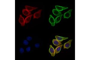 ABIN6257165 and ABIN6275114 staining HepG2 cells by IF/ICC. (EPN3 antibody  (Internal Region))