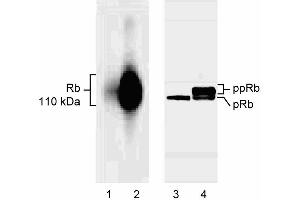 Selective binding of G99-549 to underphosphorylated Rb. (Retinoblastoma 1 antibody  (underphosphorylated))