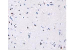 Detection of TFR in Human Brain Tissue using Anti-Transferrin Receptor (TFR) Polyclonal Antibody (Transferrin Receptor antibody  (AA 567-744))