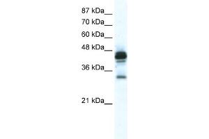 WB Suggested Anti-GJE1 Antibody Titration:  2. (GJE1 antibody  (C-Term))