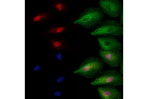ABIN6257713 and ABIN6273763 staining  cells by IF/ICC.