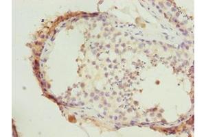 Immunohistochemistry of paraffin-embedded human testis tissue using ABIN7164431 at dilution of 1:100