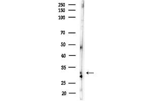 anti-Distal-Less Homeobox 5 (DLX5) (Internal Region) antibody