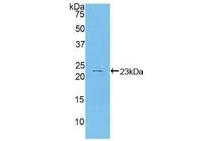 Detection of Recombinant HSPb2, Human using Polyclonal Antibody to Heat Shock Protein Beta 2 (HSPb2) (HSPB2 antibody  (AA 12-182))