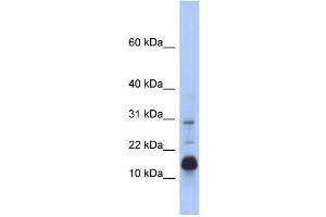 WB Suggested Anti-HIST2H2BF Antibody Titration: 0. (HIST2H2BF antibody  (N-Term))