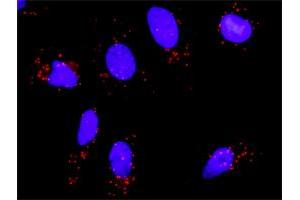 Proximity Ligation Analysis of protein-protein interactions between SMARCB1 and BAZ1B. (BAZ1B antibody  (AA 1384-1483))