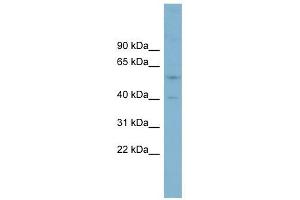 SUSD4 antibody used at 1 ug/ml to detect target protein.