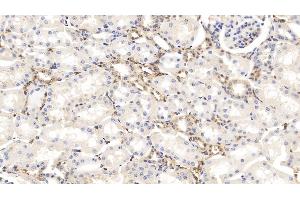 Immunohistochemistry (IHC) image for anti-Gelsolin (GSN) (AA 170-423) antibody (ABIN7428656)