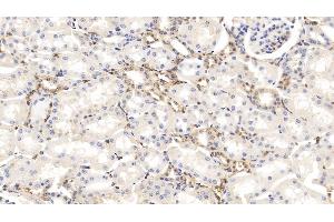 Detection of GSN in Bovine Kidney Tissue using Monoclonal Antibody to Gelsolin (GSN) (Gelsolin antibody  (AA 170-423))