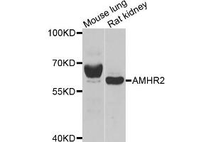 Western blot analysis of extracts of various cell lines, using AMHR2 antibody (ABIN5973908) at 1/1000 dilution. (AMHR2 antibody)