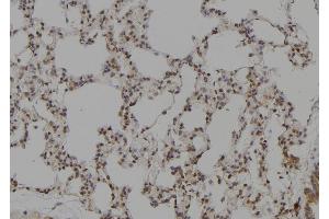 ABIN6276381 at 1/100 staining Rat lung tissue by IHC-P.