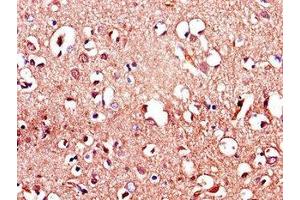 Immunohistochemistry of paraffin-embedded human brain tissue using ABIN7158114 at dilution of 1:100 (LRRTM4 antibody  (AA 259-419))